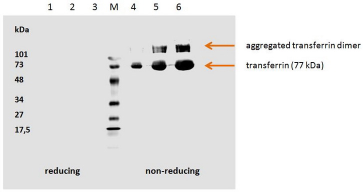 Human transferrin detected by the mouse monoclonal antibody HTF-14.