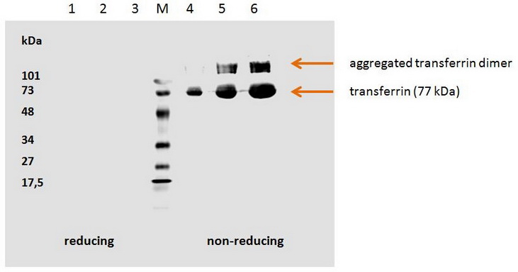 Human transferrin detected by the mouse monoclonal antibody HTF-14.1. hTransferrin; 5 g/well (red. con.)2. hTransferrin; 3 g/well (red. con.)3. hTransferrin; 1 g/well (red. con.) M Low Range marker (Bio-Rad)4. hTransferrin; 1 g/well (non-red. con.)5. hTran