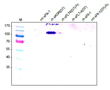 Western analysis of recombinant human and mouse soluble VEGF receptors using a monoclonal antibody directed against human recombinant sKDR (D7). There is no cross reactivity with mouse sFlk-1 as well as with human sFLT-4 and human and mouse sFlt-1visible.