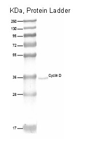Western blot analysis of human lung cell extract with Cyclin D1 antibody (DRM003)