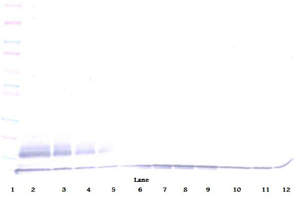 WB Suggested Anti-SLC1A2 Antibody Titration: 0.2-1ug/ml; ELISA Titer: 1:312500; Positive Control: Human brain