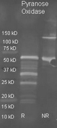 Lanes: Lane 1: 10ug myc-hTRAK1 transfected HEK293 lysate; Primary Antibody Dilution: 1: 500; Secondary Antibody: Anti-rabbit HRP; Secondary Antibody Dilution: 1: 2000; Gene Name: TRAK1; Submitted by: Gulcin Pekkurnaz, F.M. Kirby Neurobiology Center;
