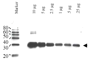 Figure 1. Western blot using Affinity Purified anti-Yeast ULP-1 antibody shows detection of a truncated ULP-1 fusion protein (arrowhead). Increasing concentrations of yeast ULP-1 were run on a SDS-PAGE, transferred onto nitrocellulose, and blocked for 1 hour with 5% non-fat dry milk in TTBS, and probed overnight at 4°C with a 1:1000 dilution of anti-yULP-1 antibody in 5% non-fat dry milk in TTBS. Detection occurred using a 1:1,000 dilution of HRP-labeled Donkey anti-Rabbit IgG for 1 hour at room temperature. A chemiluminescence system was used for signal detection (Roche) using a 3-sec exposure time.