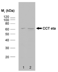 Western blot analysis of HeLa whole cell lysate (lane 1) and HeLa heat stressed whole cell lysate (lane 2) probed with rat anti CCT Eta Cat.-No. SM2019P followed by F (ab)2 rabbit anti rat IgG:HRP (Cat.No. SP1021HRP).