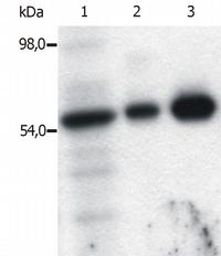 Figure 4. Immunoprecipitation of Fyn from the lysate of T cells isolated from fresh buffy coats. Western blot was immunostained with anti-Fyn (FYN-01). Lane 1: original lysate of T cells. Lane 2-3: Immunoprecipitated material eluted from affinity sorbent (FYN-01 coupled to Sepharose beads). Lanes differ in amount of T cell lysate loaded on the immunosorbent.