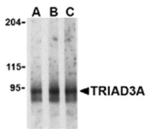 Western blot analysis of mouse heart lysate probed with Rabbit anti Mouse TRIAD3A at 0.5 (A), 1 (B) and 2 (C) ug/ml
