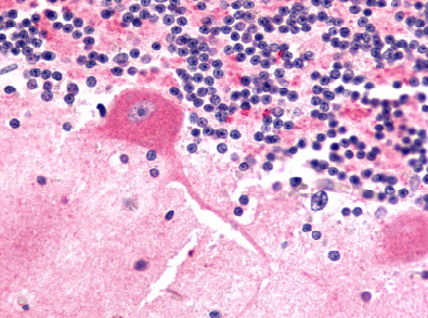 Immunohistochemical staining of Brain (Purkinje neurons) using anti-FZD9 antibody