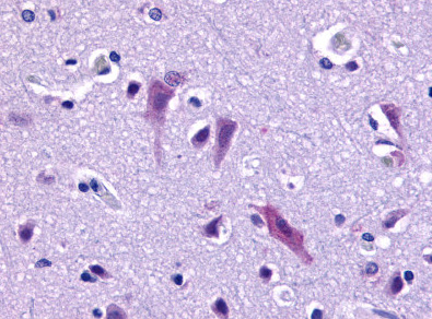 Immunohistochemical staining of Brain (Neurons and Glia) using anti-GPR103 antibody