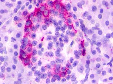 Immunohistochemical staining of Pancreas using anti-GPR35 antibody