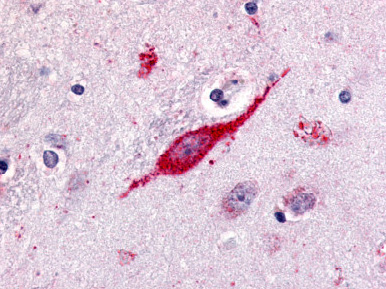 Immunohistochemical staining of Brain (Neuron) using anti-GPR85 antibody