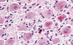 Immunohistochemistry staining of human ganglion cells and Schwann cells (Formalin-fixed, Paraffin-embedded tissue after heat-induced antigen retrieval) using MRGPRX1 antibody. (N-term).