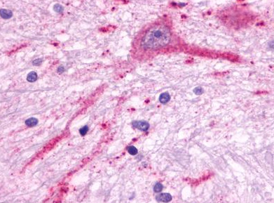 Immunohistochemical staining of Brain (Neurons) using anti-MCHR2 antibody