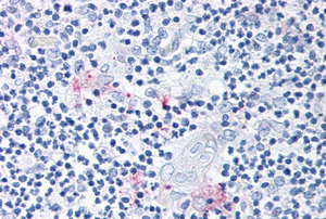 Immunohistochemistry staining of human thymus (Formalin-fixed, Paraffin-embedded tissue after heat-induced antigen retrieval) using ROR-gamma / RORC antibody.