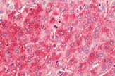 Immunohistochemical staining of Formalin-fixed, Paraffin-embedded human liver tissue using anti-HRH4 antibody no.