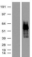 HEK293T cells were transfected with the pCMV6-ENTRY control (Left lane) or pCMV6-ENTRY tdTomato (Right lane) cDNA for 48 hrs and lysed. Equivalent amounts of cell lysates (5 ug per lane) were separated by SDS-PAGE and immunoblotted with anti-tdTomato (TA180009, 1:2000).