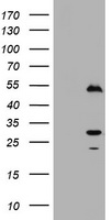 HEK293T cells were transfected with the pCMV6-ENTRY control (Left lane) or pCMV6-ENTRY Timer (switchable) (Right lane) cDNA for 48 hrs and lysed. Equivalent amounts of cell lysates (5 ug per lane) were separated by SDS-PAGE and immunoblotted with anti-Timer (switcHable).