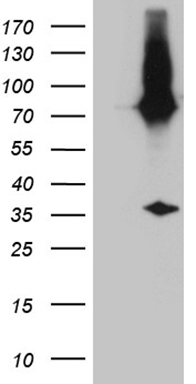 HEK293T cells were transfected with the pCMV6-ENTRY control (Left lane) or pCMV6-ENTRY E2-Crimson (JA1132-C07, Right lane) cDNA for 48 hrs and lysed. Equivalent amounts of cell lysates (5 ug per lane) were separated by SDS-PAGE and immunoblotted with anti-E2-Crimson (1:500).