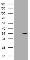 HEK293T cells were transfected with the pCMV6-ENTRY control (Left lane) or pCMV6-ENTRY DsRed-Monomer (Right lane) cDNA for 48 hrs and lysed. Equivalent amounts of cell lysates (5 ug per lane) were separated by SDS-PAGE and immunoblotted with anti-DsRed-Monomer.