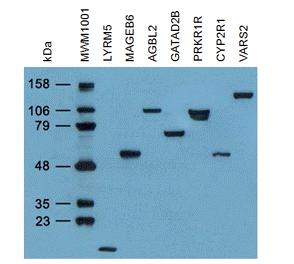 Western blot detection of hHR23b in A431, K562, Jurkat, C6, 3T3 and Hela cell lysates using hHR23b mouse mAb (1:1000 diluted).Predicted band size:58KDa.Observed band size:58KDa.Exposure time:5min.