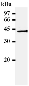 Western blot anaylsis: SM3053A HLA-E antibody staining of Human Placenta extracts