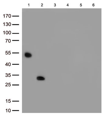 Immunoblot analysis of 6 different native protein (Lane 1.Rabbit IgG; 2.Rabbit IgG Fc; 3.Rabbit kappa light chain; 4.Rabbit lambda light chain; 5.Human IgG; 6.Rat IgG) with TA815425 at 1:500.