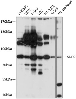 WB Suggested Anti-OAT Antibody Titration: 5.0ug/ml; Positive Control: HepG2 cell lysate