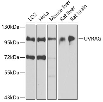 WB Suggested Anti-SEPT10 (septin 10) Antibody Titration: 1.25ug/ml; Positive Control: Jurkat cell lysate