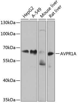 WB using the antibody against H3K36me2 diluted 1:1,000 in TBS-Tween containing 5% skimmed milk. The position of the protein of interest is indicated on the right; the marker (in kDa) is shown on the left. The result of the Western analysis with the antibody is shown in lane 1; lane 2 shows the same analysis after incubation of the antibody with 5 nmol blocking peptide for 1 hour at room temperature.