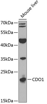 WB using the antibody against H3K79me3, diluted 1:1,000 in TBS-Tween containing 5% skimmed milk. The molecular weight marker is shown on the right; the location of the protein of interest is indicated on the left.
