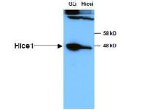 Anti-HICE1 in Western Blot using Rockland Immunochemicals Anti-HICE1 Antibody shows detection of a 45 kDa band corresponding to endogenous HICE1 in lysates of S phase HeLa cells silenced for either control Luciferase or HICE1. In right lane (HICE1i): lysates from sh-HICE1 RNAi-treated lentivirus-infected cells. In left lane (GLi): lysates from sh-Luciferase lentivirus-infected cells as control. Anti-HICE1 Antibody was used at 1:10,000. Molecular weight estimation was made by comparison by prestained MW markers. ECL was used for detection. Personal communication, Kyung S. Lee, NCI, Bethesda, MD.