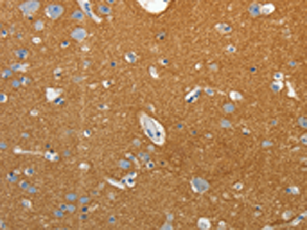 Immunohistochemistry of paraffin-embedded Human brain tissue using TA321263 (SSTR4 Antibody) at dilution 1/25 (Original magnification: x200)