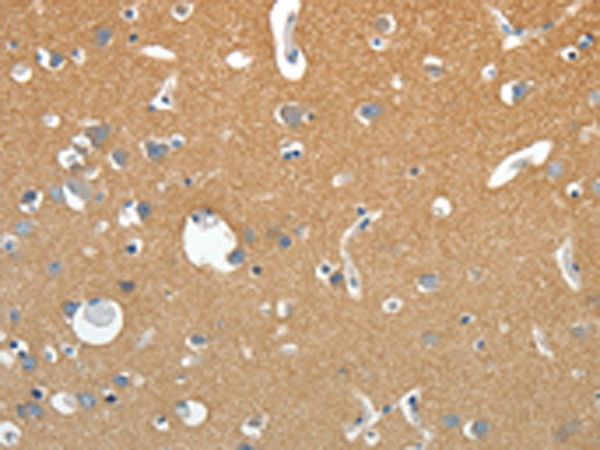 Immunohistochemistry of paraffin-embedded Human brain tissue using TA321264 (SSTR4 Antibody) at dilution 1/20 (Original magnification: x200)