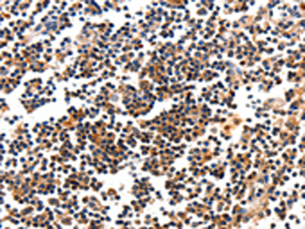 Immunohistochemistry of paraffin-embedded Human tonsil tissue using TA321588 (CAMK1 Antibody) at dilution 1/10 (Original magnification: x200)