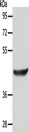 Gel: 10%SDS-PAGE Lysate: 40 microg Lane: Jurkat cells Primary antibody: TA321927 (ACTRT1 Antibody) at dilution 1/125 Secondary antibody: Goat anti rabbit IgG at 1/8000 dilution Exposure time: 10 seconds