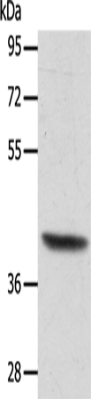 Gel: 10%SDS-PAGE Lysate: 40 microg Lane: Human lymphoma tissue Primary antibody: TA321928 (ACTRT1 Antibody) at dilution 1/350 Secondary antibody: Goat anti rabbit IgG at 1/8000 dilution Exposure time: 5 seconds