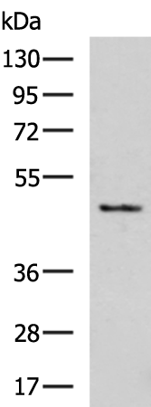 Gel: 8%SDS-PAGE Lysate: 40 microg Lane: Mouse skin tissue lysate Primary antibody: TA322212 (CERS2 Antibody) at dilution 1/400 Secondary antibody: Goat anti rabbit IgG at 1/5000 dilution Exposure time: 90 seconds
