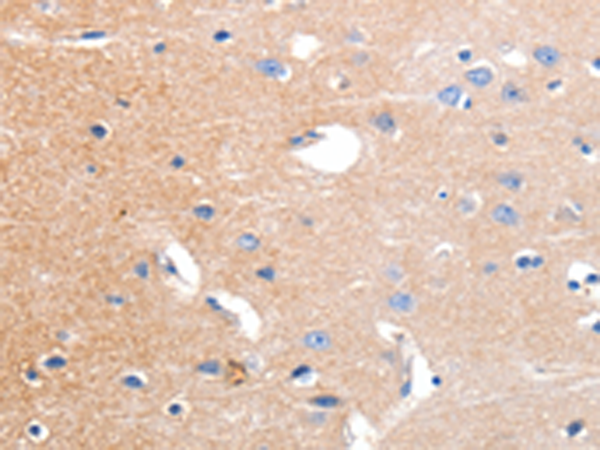 Immunohistochemistry of paraffin-embedded Human brain tissue using TA322410 (KCNH3 Antibody) at dilution 1/12 (Original magnification: x200)