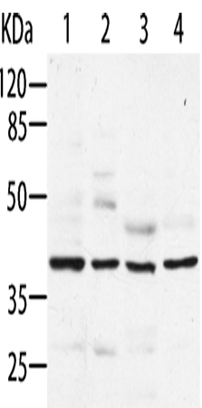 Gel: 8%SDS-PAGE Lysate: 40 microg Lane 1-4: Hela cells HepG2 cells MCF7 cells HT29 cells Primary antibody: TA322514 (AIMP2 Antibody) at dilution 1/200 Secondary antibody: Goat anti rabbit IgG at 1/8000 dilution Exposure time: 1 minute