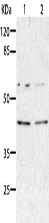 Gel: 8%SDS-PAGE Lysate: 40 microg Lane 1-2: HepG2 cells A549 cells Primary antibody: TA322515 (AIMP2 Antibody) at dilution 1/350 Secondary antibody: Goat anti rabbit IgG at 1/8000 dilution Exposure time: 1 minute