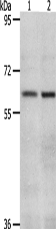 Gel: 8%SDS-PAGE Lysate: 40 microg Lane 1-2: K562 cells hela cells Primary antibody: TA322714 (VNN2 Antibody) at dilution 1/350 Secondary antibody: Goat anti rabbit IgG at 1/8000 dilution Exposure time: 45 seconds