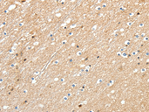 Immunohistochemistry of paraffin-embedded Human brain tissue using TA322781 (RRAD Antibody) at dilution 1/30 (Original magnification: x200)