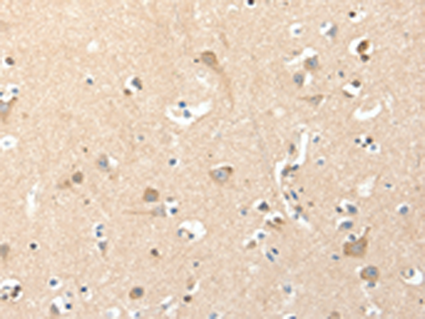 Immunohistochemistry of paraffin-embedded Human brain tissue using TA322782 (RRAD Antibody) at dilution 1/50 (Original magnification: x200)