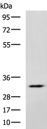 Gel: 8%SDS-PAGE Lysate: 40 microg Lane: Mouse brain tissue lysate Primary antibody: TA322788 (FOXS1 Antibody) at dilution 1/800 Secondary antibody: Goat anti rabbit IgG at 1/5000 dilution Exposure time: 2 minutes