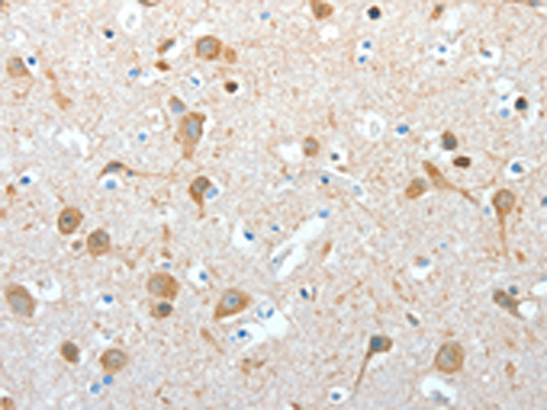 Immunohistochemistry of paraffin-embedded Human brain tissue using TA322811 (AKAP4 Antibody) at dilution 1/10 (Original magnification: x200)