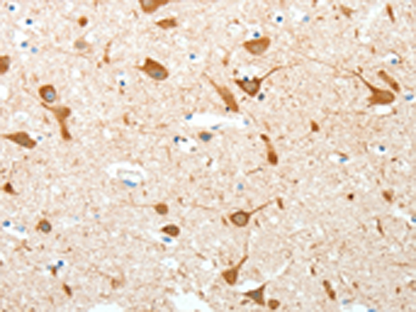 Immunohistochemistry of paraffin-embedded Human brain tissue using TA322812 (AKAP4 Antibody) at dilution 1/10 (Original magnification: x200)