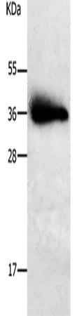 WB: The whole cell lysate derived from HEK293 overepressed Shaker cell lysate separated in SDS-PAGE, transferred onto a NC membrane, then blotted by Rabbit anti-Shaker antibody at 1:500. An immunoreactive band is observed around ~73 kDa.