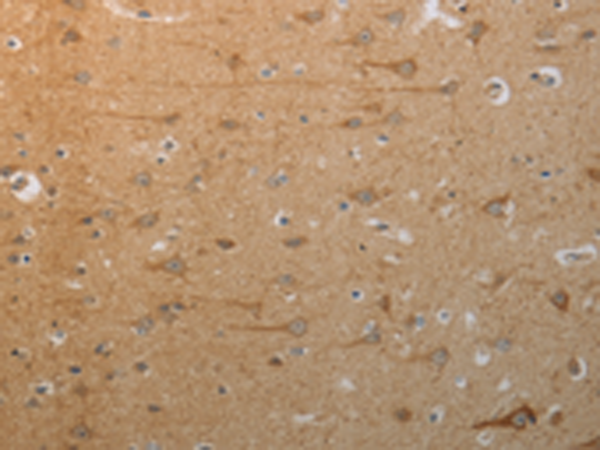 Immunohistochemistry of paraffin-embedded Human brain tissue using TA322834 (SLC4A7 Antibody) at dilution 1/50 (Original magnification: x200)