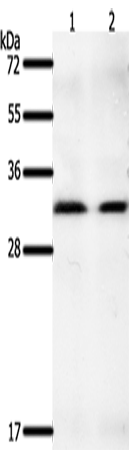 Gel: 10%SDS-PAGE Lysate: 40 microg Lane 1-2: K562 cells hela cells Primary antibody: TA322836 (GEMIN2 Antibody) at dilution 1/400 Secondary antibody: Goat anti rabbit IgG at 1/8000 dilution Exposure time: 2 minutes