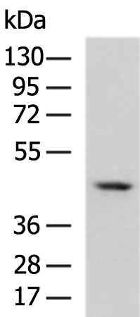 Gel: 8%SDS-PAGE Lysate: 40 microg Lane: Human cerebrum tissue lysate Primary antibody: TA322890 (SYT5 Antibody) at dilution 1/500 Secondary antibody: Goat anti rabbit IgG at 1/5000 dilution Exposure time: 1 second