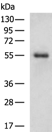 Gel: 8%SDS-PAGE Lysate: 40 microg Lane: Human liver cancer tissue Primary antibody: TA322903 (SPAG4 Antibody) at dilution 1/1000 Secondary antibody: Goat anti rabbit IgG at 1/5000 dilution Exposure time: 4 minutes